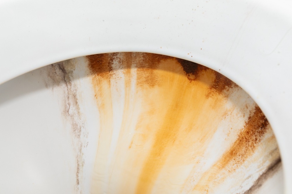 The Best Ways To Remove Gross Brown Toilet Stains